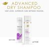 imageDove Dry Shampoo for 2 Count for Oily Hair Volume ampamp Fullness for Refreshed Hair 5 ozFragranced