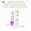 imageDove Dry Shampoo for 2 Count for Oily Hair Volume ampamp Fullness for Refreshed Hair 5 ozFragranced