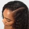 imageDove Scalp  Hair Therapy Density Boost Serum Fullness Restore Visibly Thicker Hair In As Soon As 30 Days Hydrating ampamp FastAbsorbing Instantly Relieves Dry Scalp 2 Fl ozScalp Serum