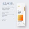 imageDove Targeted Serum Multipurpose for Stretch Marks Dark Spots Uneven Skin Tone and Elasticitywith Tone Balance Complex Niacinamide Collagen Peptides and Natural Moisturizing Factors 32 oz